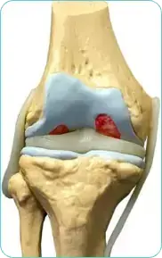 Settimana 2 – Miglioramento della mobilità