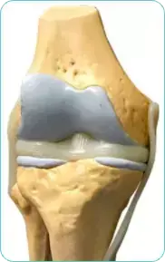 Settimana 4 – Vita attiva senza dolore